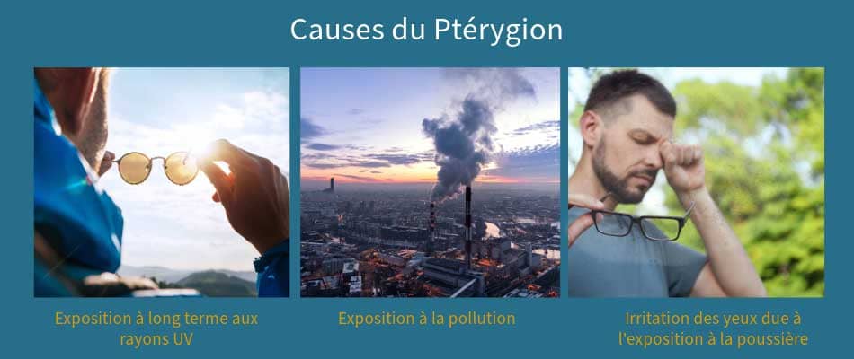 causes ptérygion oeil