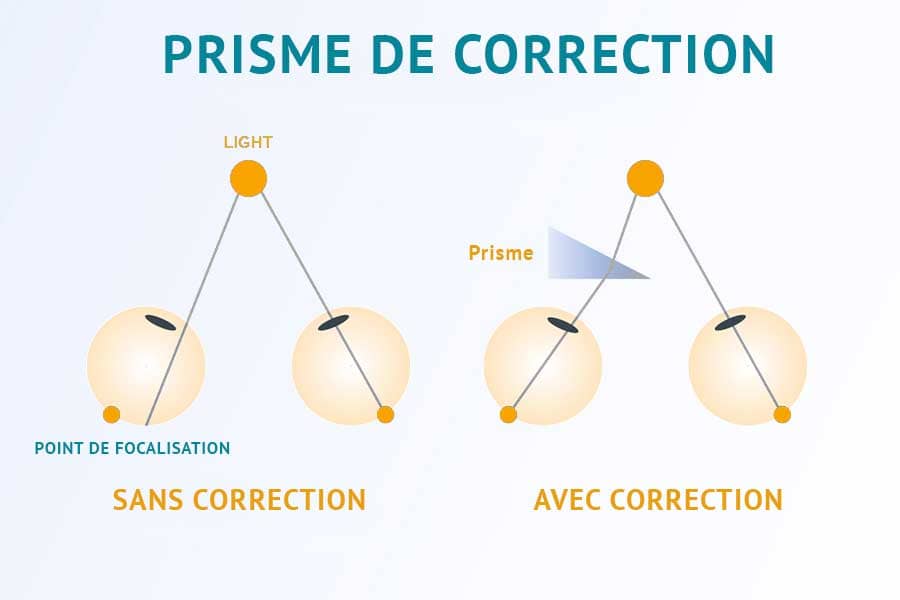 prisme correction lunette diplopie fonctionnement