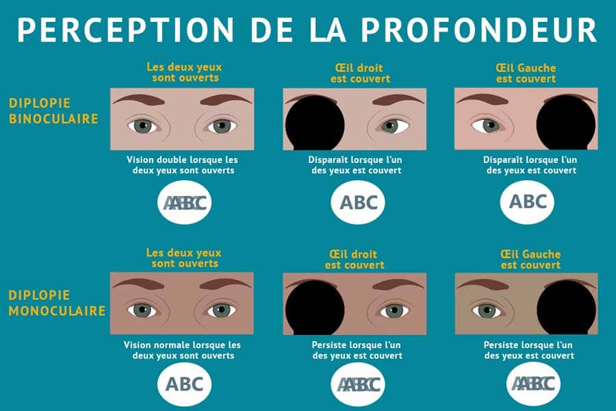 perception de l'oeir avec diplopie binoculaire et monoculaire