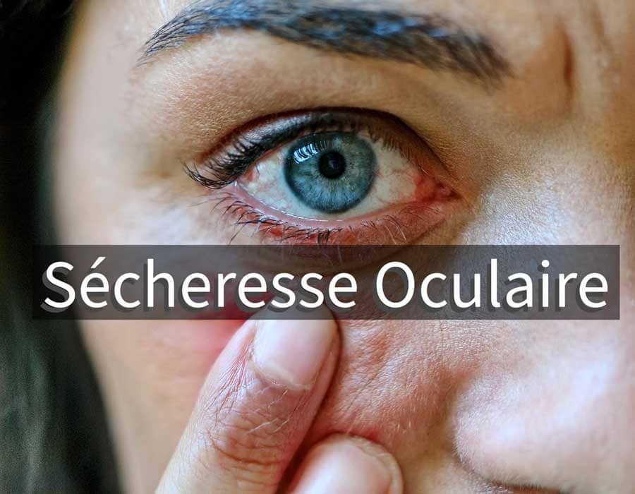 oeil-secheresse-oculaire